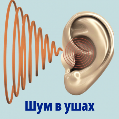 [Оверченко К. В. Борисов А. С.] Все о шуме в ушах: видеогайд (2023)